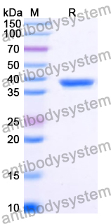 Recombinant Human BDP1 Protein, N-GST & C-His