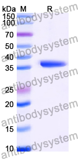 Recombinant Human PGP Protein, N-His
