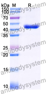 Recombinant Human RCCD1 Protein, N-His