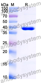 Recombinant Human MFSD2B Protein, N-GST & C-His