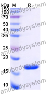 Recombinant Human OOEP Protein, N-His