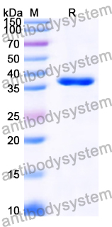 Recombinant Human HEPACAM2 Protein, N-His