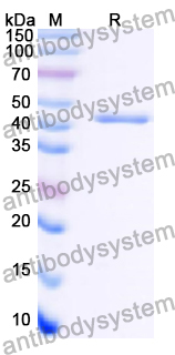 Recombinant Human KDM4E Protein, N-His
