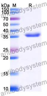 Recombinant Human MCIDAS Protein, N-GST & C-His