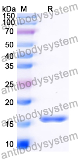 Recombinant Human KIF12 Protein, N-His