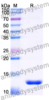 Recombinant Human Lambda chain Protein, N-His