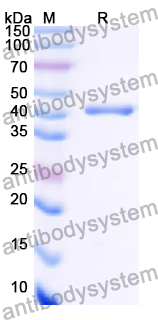 Recombinant Human FANCM Protein, N-His