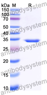 Recombinant Human USP30 Protein, N-His