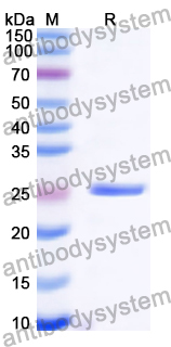 Recombinant Human SGPP2 Protein, N-His-KSI