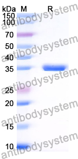 Recombinant Human USP47 Protein, N-His