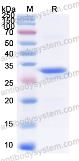 Recombinant Human GPBAR1 Protein, N-His-KSI
