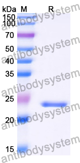 Recombinant Human PRDM9 Protein, N-His