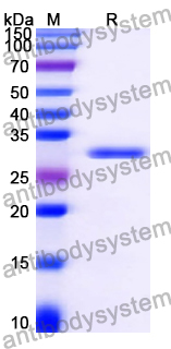 Recombinant Human SIDT1 Protein, N-His