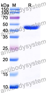 Recombinant Human SUGCT Protein, N-His