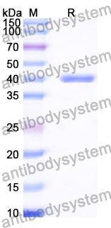 Recombinant Human OAS3 Protein, N-His