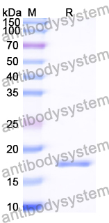 Recombinant Human JCHAIN Protein, N-His