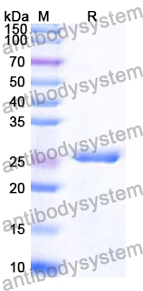 Recombinant Human METTL5 Protein, N-His