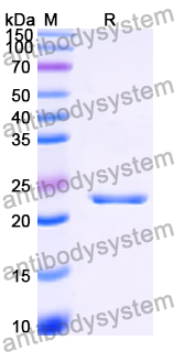 Recombinant Human MMAB Protein, N-His