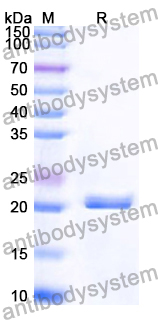 Recombinant Human KANK2 Protein, N-His