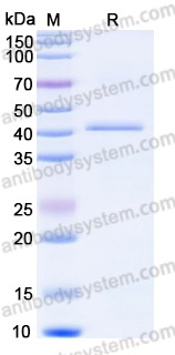 Recombinant Human CA14 Protein, N-His
