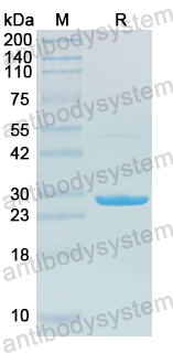 Recombinant Human GPER1 Protein, N-His-KSI