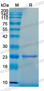 Recombinant Human SNX10 Protein, C-His