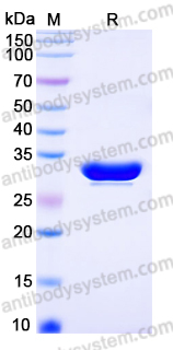 Recombinant Human TRIM5 Protein, N-His
