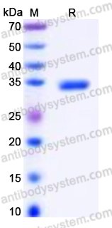 Recombinant Human UBE2Z Protein, N-His