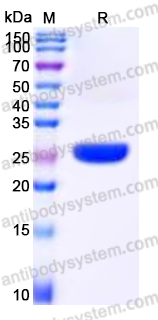 Recombinant Human SENP8 Protein, N-His