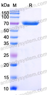 Recombinant Human PGM2 Protein, N-His