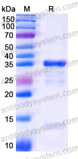 Recombinant Human UBE2R2 Protein, N-His