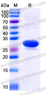 Recombinant Human DCXR Protein, N-His