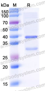 Recombinant Human ASXL1 Protein, N-GST