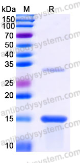 Recombinant Human ZNF100 Protein, N-His
