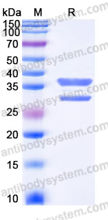 Recombinant Human UBE2J2 Protein, N-GST