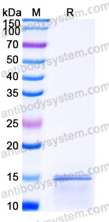 Recombinant Human UCMA Protein, Tag free
