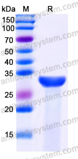 Recombinant Human ASB13 Protein, N-His
