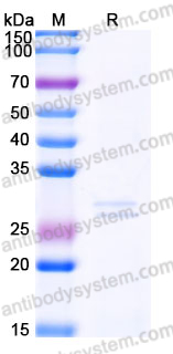 Recombinant Human RPE Protein, C-His