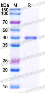 Recombinant Human UPRT Protein, N-His