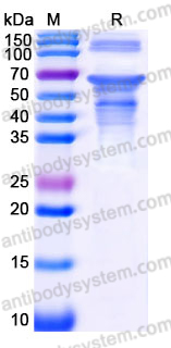 Recombinant Human ZBTB9 Protein, C-His