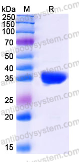 Recombinant Human GALM Protein, C-His