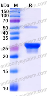 Recombinant Human PPCDC Protein, N-His
