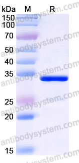 Recombinant Human ZMYND19 Protein, N-His