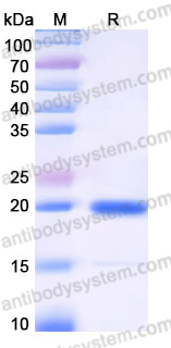 Recombinant Human WBP1 Protein, N-His