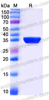 Recombinant Human DCUN1D1 Protein, N-His