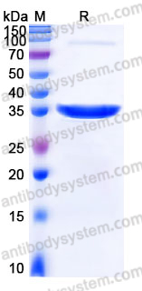 Recombinant Human ACY3 Protein, N-His