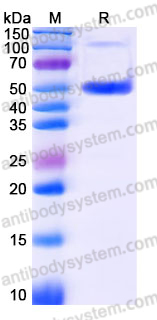 Recombinant Human SCLY Protein, N-His