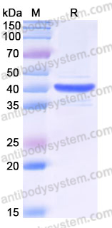 Recombinant Human CALR3 Protein, Tag free