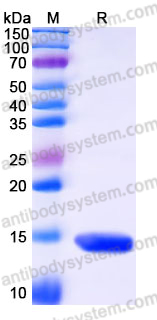 Recombinant Human ZNF75A Protein, N-His