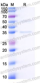 Recombinant Human MYOZ2 Protein, C-His